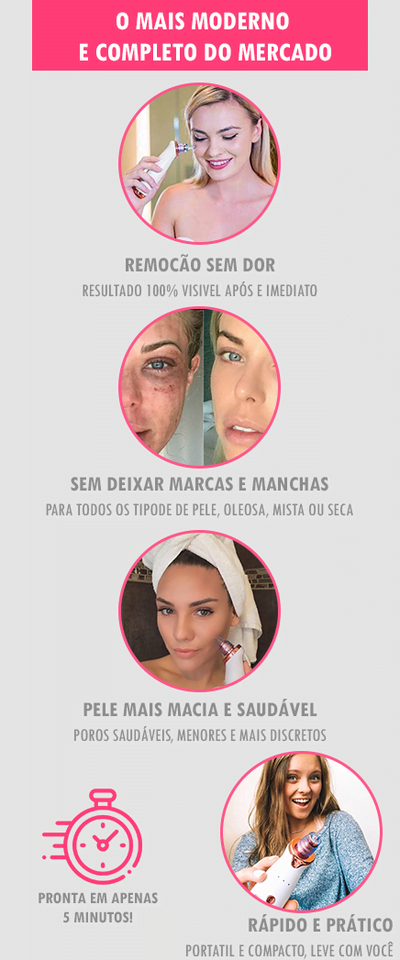 Removedor de Cravos e Espinhas a Vácuo - Image 4